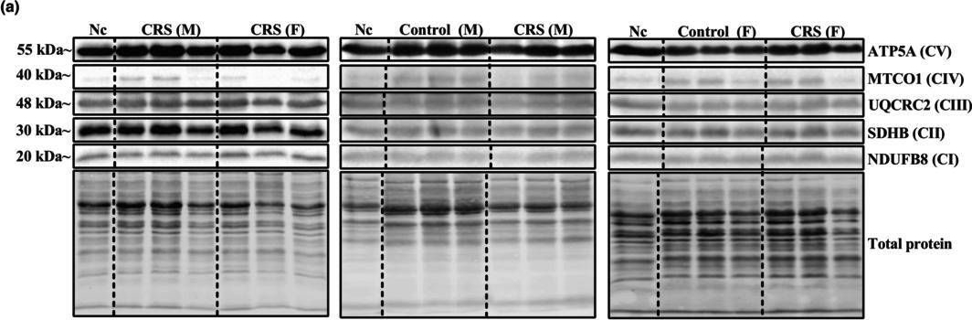 Fig.4.A showing Western Blotting in a Rattus norvegicus (Rat) sample from the publication: Chronic stress elicits sex-specific mitochondrial respiratory functional changes in the rat heart.
