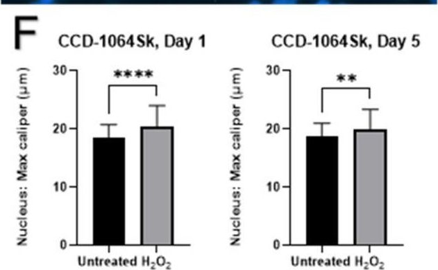 Fig.4.F from the publication: Modeling of the Senescence-Associated Phenotype in Human Skin Fibroblasts.