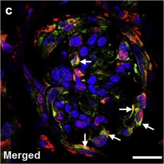 Loss of endogenous thymosin β4 accelerates glomerular disease.