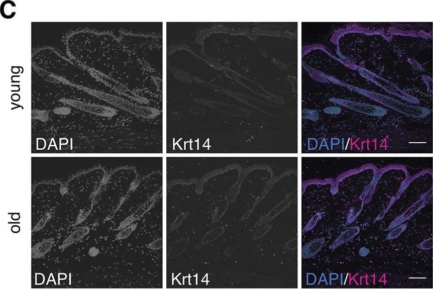 N1-acetylspermidine is a determinant of hair follicle stem cell fate.