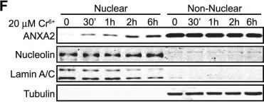 Fig.1.F showing Western Blotting in a Homo sapiens (Human) sample from the publication: Genotoxic agents promote the nuclear accumulation of annexin A2: role of annexin A2 in mitigating DNA damage.