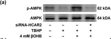 Fig.6.A showing Western Blotting from the publication: β-Hydroxybutyrate enhances chondrocyte mitophagy and reduces cartilage degeneration in osteoarthritis via the HCAR2/AMPK/PINK1/Parkin pathway.