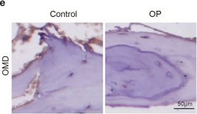 Fig.1.E showing Immunohistochemistry from the publication: Osteoblast-derived osteomodulin restrains osteoclastogenesis via ITGB8/RRM2-mediated reduction of mitochondrial respiration and mitochondrial ATP production.