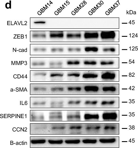 Fig.4.D showing Western Blotting in a Homo sapiens (Human) sample from the publication: ELAVL2 loss promotes aggressive mesenchymal transition in glioblastoma.