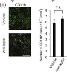 Fig.3.C showing Immunohistochemistry-immunofluorescence in a Mus musculus (House mouse) sample from the publication: Leptin sustains spontaneous remyelination in the adult central nervous system.