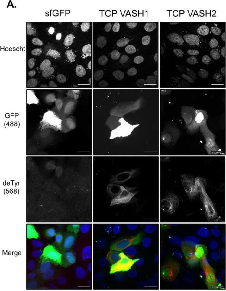 Fig.1.A showing Immunocytochemistry-immunofluorescence in a Homo sapiens (Human) sample from the publication: Tubulin Carboxypeptidase Activity Promotes Focal Gelatin Degradation in Breast Tumor Cells and Induces Apoptosis in Breast Epithelial Cells That Is Overcome by Oncogenic Signaling.