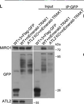 Fig.3.L showing Western Blotting in a Homo sapiens (Human) sample from the publication: ATL2 Recruits TRAK1 to Promote Mitochondrial Transport at ER-Mitochondria Contact Sites.