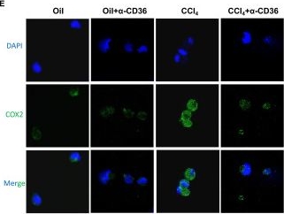 Fig.4.E showing Immunocytochemistry-immunofluorescence in a Mus musculus (House mouse) sample from the publication: CD36 aggravates ferroptosis in NK cells and dampens their anti-fibrotic activity in the liver.