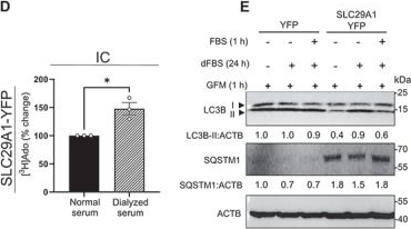 Fig.4.D showing Western Blotting in a Homo sapiens (Human) sample from the publication: SLC29A1/ENT1 and SLC29A3/ENT3 differentially regulate autophagy.