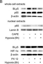 Fig.3.B showing Western Blotting in a Homo sapiens (Human) sample from the publication: BlyS is up-regulated by hypoxia and promotes migration of human breast cancer cells.