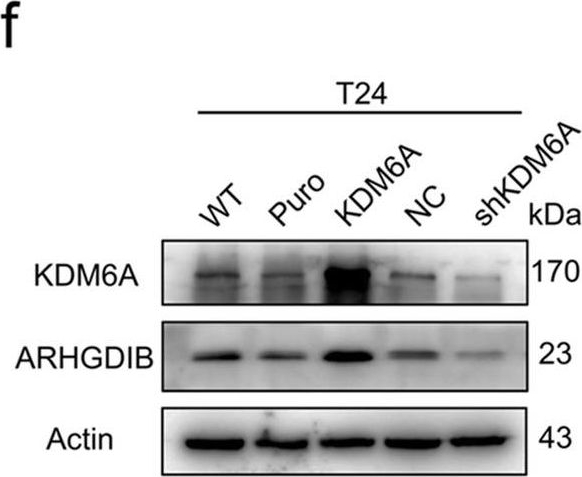 Fig.3.F showing Western Blotting in a Mus musculus (House mouse) sample from the publication: KDM6A-ARHGDIB axis blocks metastasis of bladder cancer by inhibiting Rac1.