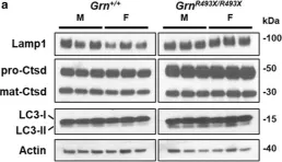 Fig.3.A showing Western Blotting in a Mus musculus (House mouse) sample from the publication: Neuropathological and behavioral characterization of aged Grn R493X progranulin-deficient frontotemporal dementia knockin mice.