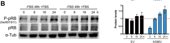 Fig.6.B showing Western Blotting in a Homo sapiens (Human) sample from the publication: Mutation of SPINOPHILIN (PPP1R9B) found in human tumors promotes the tumorigenic and stemness properties of cells.