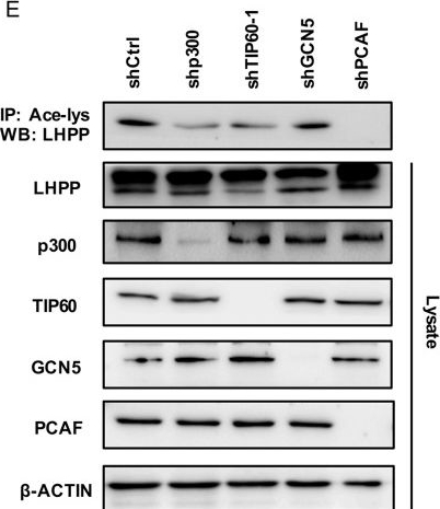 Fig.5.E showing Western Blotting in a Homo sapiens (Human) sample from the publication: m6A methylation mediates LHPP acetylation as a tumour aerobic glycolysis suppressor to improve the prognosis of gastric cancer.