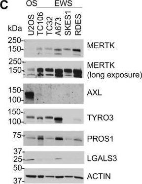 Fig.2.C showing Western Blotting from the publication: MERTK Is a Potential Therapeutic Target in Ewing Sarcoma.