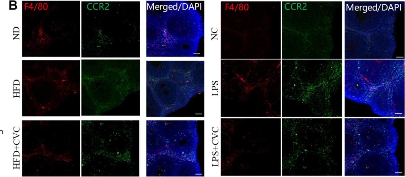 Fig.3.B showing Immunocytochemistry-immunofluorescence in a Mus musculus (House mouse) sample from the publication: Intestinal Flora Changes Induced by a High-Fat Diet Promote Activation of Primordial Follicles through Macrophage Infiltration and Inflammatory Factor Secretion in Mouse Ovaries.