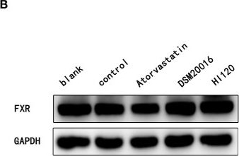 Fig.14.B showing Western Blotting in a Mus musculus (House mouse) sample from the publication: Novel Lactobacillus reuteri HI120 Affects Lipid Metabolism in C57BL/6 Obese Mice.