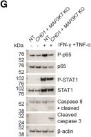 Fig.1.G showing Western Blotting in a Homo sapiens (Human) sample from the publication: CRISPR screens in the context of immune selection identify CHD1 and MAP3K7 as mediators of cancer immunotherapy resistance.