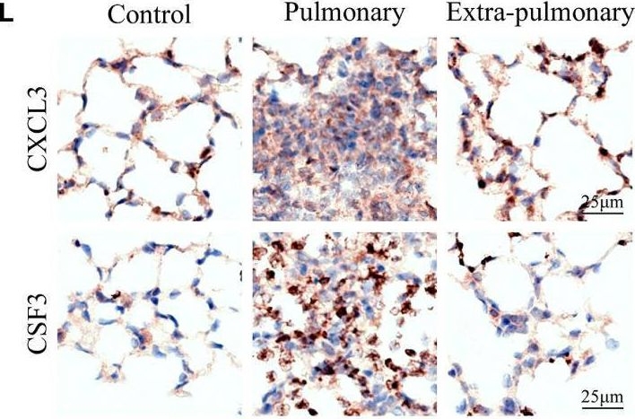 Fig.5.L showing Immunohistochemistry from the publication: Heterogeneity of immune cells and their communications unveiled by transcriptome profiling in acute inflammatory lung injury.
