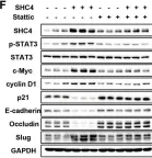 Fig.6.F showing Western Blotting from the publication: SHC4 promotes tumor proliferation and metastasis by activating STAT3 signaling in hepatocellular carcinoma.