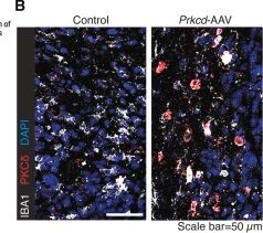 Fig.6.B showing Immunohistochemistry-immunofluorescence in a Mus musculus (House mouse) sample from the publication: Spatial single-cell profiling identifies protein kinase Cδ-expressing microglia with anti-tumor function in glioblastoma.