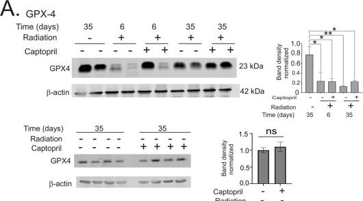 Fig.4.A showing Western Blotting from the publication: Ferroptosis, Inflammation, and Microbiome Alterations in the Intestine in the Göttingen Minipig Model of Hematopoietic-Acute Radiation Syndrome.