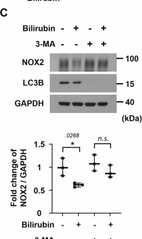Fig.8.C showing Western Blotting from the publication: Bilirubin reduces mortality in sepsis models by inhibiting NOX2-mediated formation of neutrophil extracellular traps.
