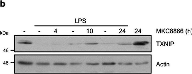 Fig.6.B showing Western Blotting in a Homo sapiens (Human) sample from the publication: Inhibition of IRE1α RNase activity reduces NLRP3 inflammasome assembly and processing of pro-IL1β.