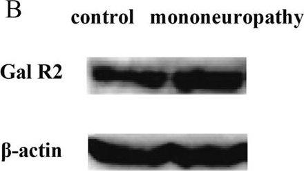 Fig.8.B showing Western Blotting in a Rattus norvegicus (Rat) sample from the publication: Involvement of galanin and galanin receptor 2 in nociceptive modulation in anterior cingulate cortex of normal rats and rats with mononeuropathy.