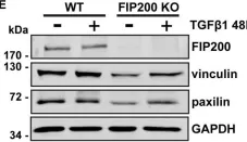 Fig.5.E showing Western Blotting in a Homo sapiens (Human) sample from the publication: Loss of the Essential Autophagy Regulators FIP200 or Atg5 Leads to Distinct Effects on Focal Adhesion Composition and Organization.