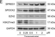 Tri-Methyl-Histone H3 (Lys27) (C36B11) Rabbit mAb (BSA and