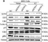 Fig.3.B showing Western Blotting from the publication: The lysine acetyltransferase GCN5 contributes to human papillomavirus oncoprotein E7-induced cell proliferation via up-regulating E2F1.