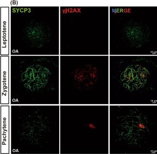 Fig.3.B showing Immunocytochemistry-immunofluorescence in an Arachis hypogaea (Peanut) sample from the publication: Compound heterozygous REC114 variants in dizygotic twins causes meiotic arrest and non-obstructive azoospermia.