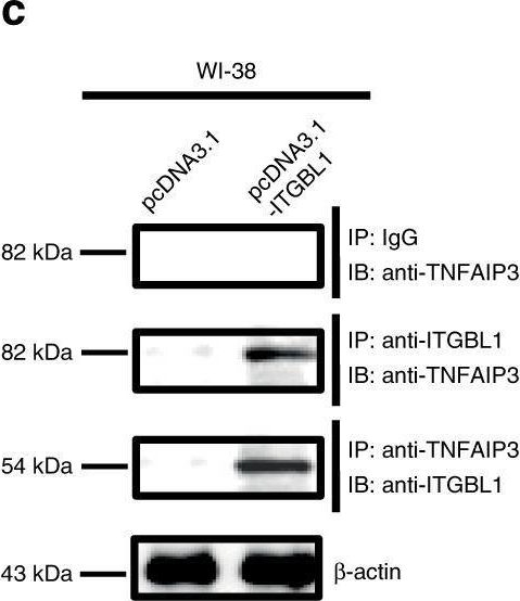 Fig.6.C showing Western Blotting in a Homo sapiens (Human) sample from the publication: Primary tumors release ITGBL1-rich extracellular vesicles to promote distal metastatic tumor growth through fibroblast-niche formation.