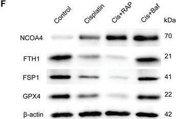 Fig.4.L showing Western Blotting from the publication: FOXO1-NCOA4 Axis Contributes to Cisplatin-Induced Cochlea Spiral Ganglion Neuron Ferroptosis via Ferritinophagy.