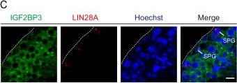 Fig.1.C showing Immunohistochemistry-immunofluorescence in a Mus musculus (House mouse) sample from the publication: IGF2BP3 recognizes m6A to regulate histone-to-protamine replacement during mouse sperm development.