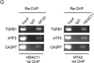 Fig.5.G showing Western Blotting from the publication: HDAC11 interacts with the NuRD (MTA3) complex to transcriptionally suppress TGFβ1 expression and inhibit hepatocellular carcinoma metastasis.