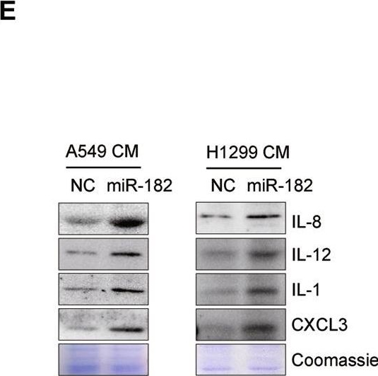 Fig.4.E showing Western Blotting in a Homo sapiens (Human) sample from the publication: A novel microRNA-182/Interleukin-8 regulatory axis controls osteolytic bone metastasis of lung cancer.