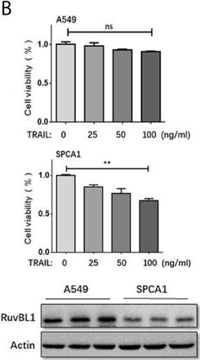 Fig.1.B showing Western Blotting in a Homo sapiens (Human) sample from the publication: RuvBL1 Maintains Resistance to TRAIL-Induced Apoptosis by Suppressing c-Jun/AP-1 Activity in Non-Small Cell Lung Cancer.