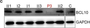 Fig.1.C showing Western Blotting from the publication: Clinical and Immunological Features of Human BCL10 Deficiency.