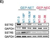 Fig.1.E showing Western Blotting from the publication: Novel preclinical gastroenteropancreatic neuroendocrine neoplasia models demonstrate the feasibility of mutation-based targeted therapy.