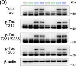 Fig.8.D showing Western Blotting in a Mus musculus (House mouse) sample from the publication: Astrocytic PYGM attenuates tau pathology by promoting lactate-mediated neuroprotection.