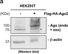 Fig.5.A showing Western Blotting from the publication: TRMT6/61A-dependent base methylation of tRNA-derived fragments regulates gene-silencing activity and the unfolded protein response in bladder cancer.
