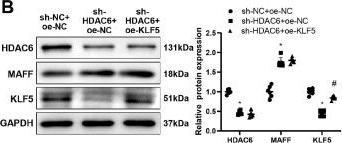 Fig.5.B showing Western Blotting from the publication: HDAC6 promotes inflammation in lupus nephritis mice by regulating transcription factors MAFF and KLF5 in renal fibrosis.
