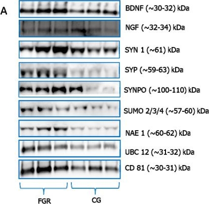 Fig.2.A showing Western Blotting in a Homo sapiens (Human) sample from the publication: Fetal Neuronal Vesicles in the Assessment of Perinatal Brain Dysfunction and Late-Onset Growth Restriction: A Pilot Study.
