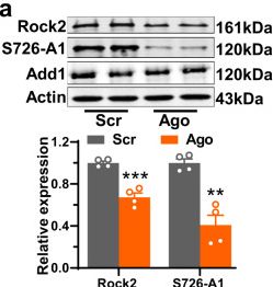 Fig.6.A showing Western Blotting from the publication: miR-135a-5p mediates memory and synaptic impairments via the Rock2/Adducin1 signaling pathway in a mouse model of Alzheimer's disease.