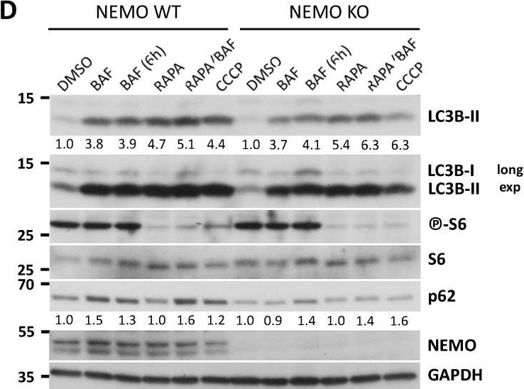 p62 Promotes Survival and Hepatocarcinogenesis in Mice with Liver-Specific NEMO Ablation.