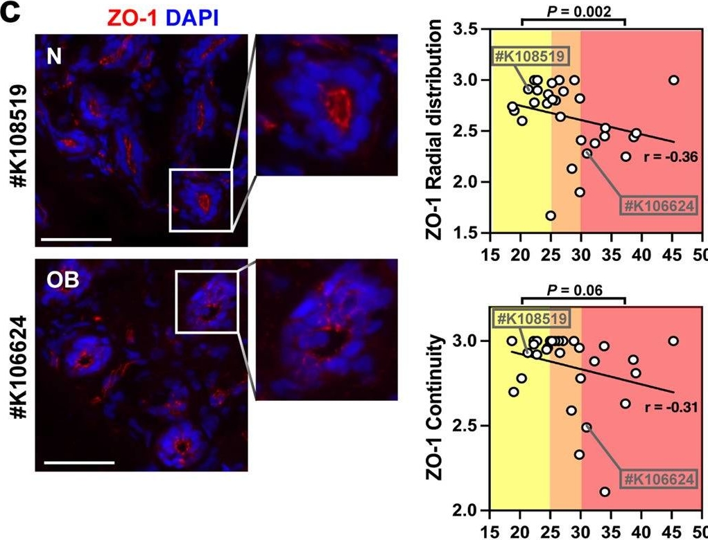 Fig.1.C showing Immunocytochemistry-immunofluorescence from the publication: Reversion of breast epithelial polarity alterations caused by obesity.