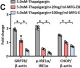 Fig.1.C from the publication: MFG-E8 Maintains Cellular Homeostasis by Suppressing Endoplasmic Reticulum Stress in Pancreatic Exocrine Acinar Cells.