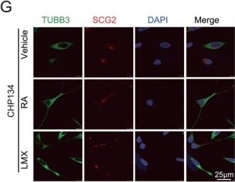 Fig.3.G showing Immunocytochemistry-immunofluorescence from the publication: Inhibition of Purine Metabolism Promotes the Differentiation of Neuroblastoma Driven by MYCN.